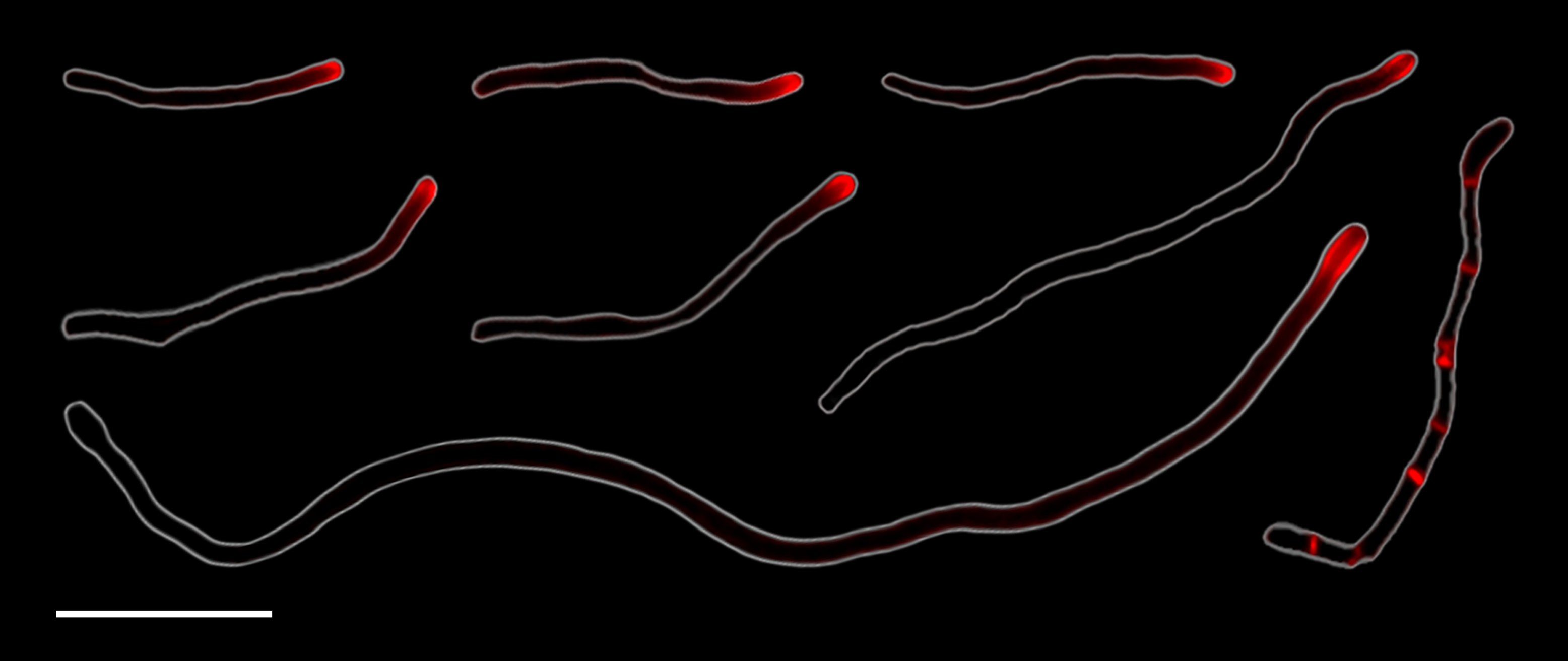 Open Wide: Human Mouth Bacteria Reproduce through Rare Form of